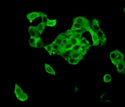 Invitrogen TTK Polyclonal Antibody:Antibodies:Primary Antibodies