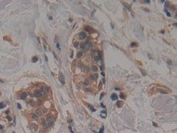 Invitrogen TTK Polyclonal Antibody:Antibodies:Primary Antibodies