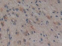 Invitrogen TTK Polyclonal Antibody:Antibodies:Primary Antibodies