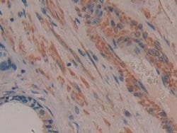 Invitrogen TTK Polyclonal Antibody:Antibodies:Primary Antibodies