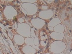 Invitrogen TTK Polyclonal Antibody:Antibodies:Primary Antibodies