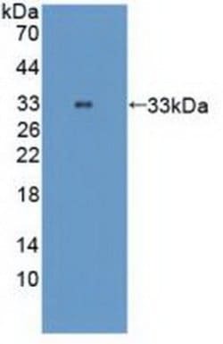 Invitrogen TTK Polyclonal Antibody:Antibodies:Primary Antibodies