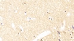Invitrogen TUBB1 Polyclonal Antibody:Antibodies:Primary Antibodies