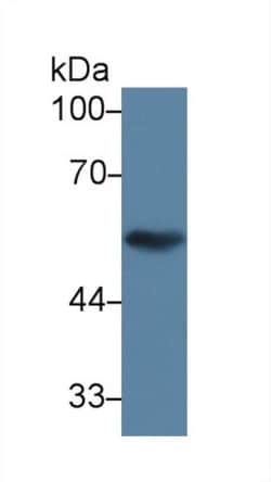 Invitrogen TUBB1 Polyclonal Antibody 20 &mu;L; Unconjugated:Antibodies,