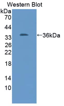 Invitrogen TUBB1 Polyclonal Antibody 20 &mu;L; Unconjugated:Antibodies,