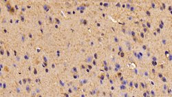 Invitrogen TUBB6 Polyclonal Antibody 200 &mu;L; Unconjugated:Antibodies,