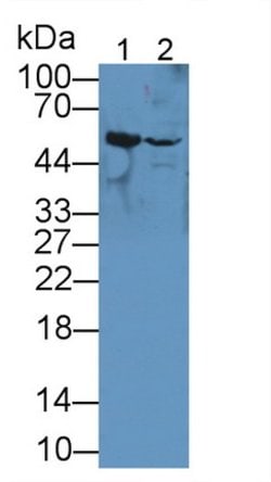Invitrogen TUBB6 Polyclonal Antibody 200 &mu;L; Unconjugated:Antibodies,