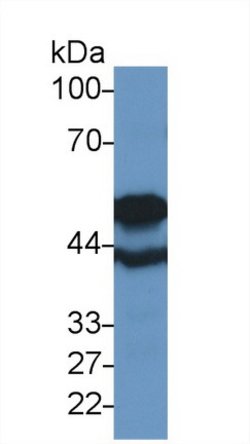 Invitrogen TUBB6 Polyclonal Antibody 200 &mu;L; Unconjugated:Antibodies,
