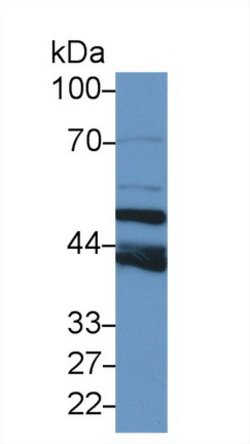 Invitrogen TUBB6 Polyclonal Antibody 200 &mu;L; Unconjugated:Antibodies,