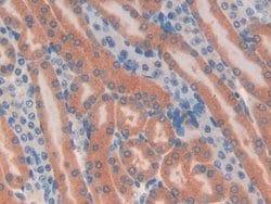 TUBD1 Polyclonal Antibody, Invitrogen 20 &mu;L; Unconjugated:Antibodies,