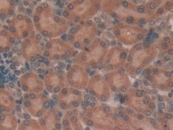 Invitrogen TUBD1 Polyclonal Antibody:Antibodies:Primary Antibodies