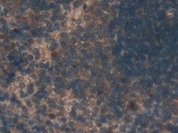 Invitrogen TUBD1 Polyclonal Antibody:Antibodies:Primary Antibodies