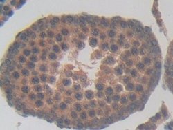 Invitrogen TUBD1 Polyclonal Antibody:Antibodies:Primary Antibodies