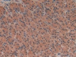 Invitrogen TUBD1 Polyclonal Antibody:Antibodies:Primary Antibodies