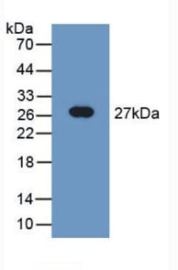 Invitrogen TUBD1 Polyclonal Antibody:Antibodies:Primary Antibodies