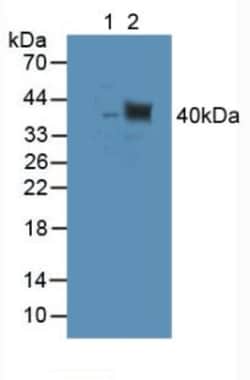 Invitrogen TUBD1 Polyclonal Antibody:Antibodies:Primary Antibodies