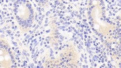 Invitrogen TUBD1 Polyclonal Antibody 20 &mu;L; Unconjugated:Antibodies,