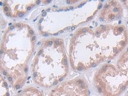 Invitrogen TUBD1 Polyclonal Antibody 20 &mu;L; Unconjugated:Antibodies,
