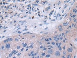 Invitrogen TUBD1 Polyclonal Antibody 20 &mu;L; Unconjugated:Antibodies,