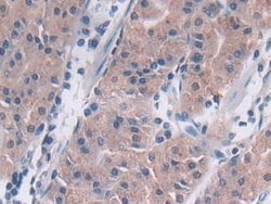 Invitrogen TUBD1 Polyclonal Antibody 20 &mu;L; Unconjugated:Antibodies,