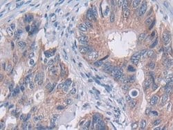 Invitrogen TUBD1 Polyclonal Antibody 20 &mu;L; Unconjugated:Antibodies,