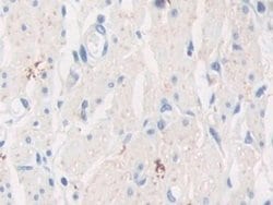 Invitrogen TPPP Polyclonal Antibody 20 &mu;L; Unconjugated:Antibodies,