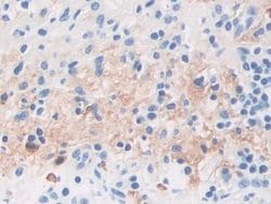 Invitrogen TPPP Polyclonal Antibody 20 &mu;L; Unconjugated:Antibodies,