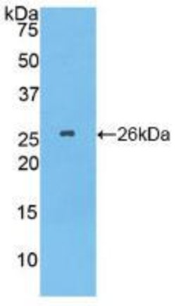 Invitrogen TPPP Polyclonal Antibody 20 &mu;L; Unconjugated:Antibodies,