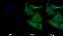 Invitrogen TNFR1 Polyclonal Antibody:Antibodies:Primary Antibodies