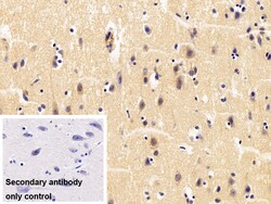 Invitrogen TNFR1 Polyclonal Antibody:Antibodies:Primary Antibodies