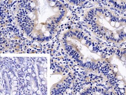 Invitrogen TNFR1 Polyclonal Antibody:Antibodies:Primary Antibodies