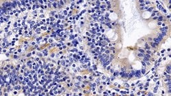 Invitrogen TNFR1 Polyclonal Antibody:Antibodies:Primary Antibodies