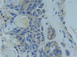 Invitrogen TNFR1 Polyclonal Antibody:Antibodies:Primary Antibodies