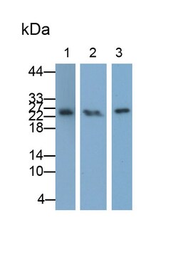 Invitrogen TNFR1 Polyclonal Antibody:Antibodies:Primary Antibodies