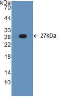 Invitrogen TNFR1 Polyclonal Antibody:Antibodies:Primary Antibodies