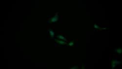 Invitrogen p53 Polyclonal Antibody 20 &mu;L; Unconjugated:Antibodies, Polyclonal