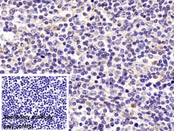 Invitrogen p53 Polyclonal Antibody:Antibodies:Primary Antibodies
