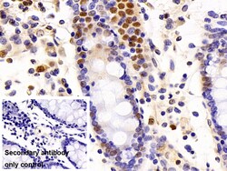Invitrogen p53 Polyclonal Antibody:Antibodies:Primary Antibodies