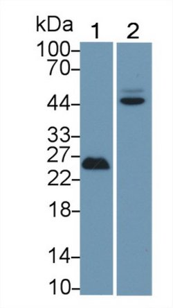 Invitrogen p53 Polyclonal Antibody 20 &mu;L; Unconjugated:Antibodies, Polyclonal