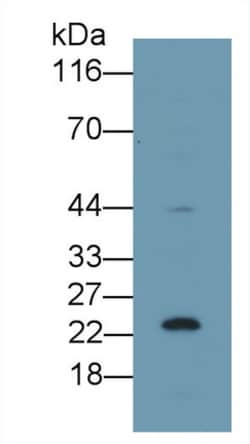 Invitrogen p53 Polyclonal Antibody:Antibodies:Primary Antibodies