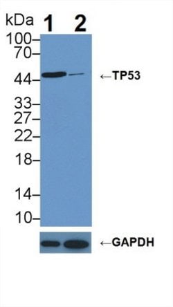 Invitrogen p53 Polyclonal Antibody 20 &mu;L; Unconjugated:Antibodies, Polyclonal