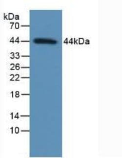 Invitrogen p53 Polyclonal Antibody 20 &mu;L; Unconjugated:Antibodies, Polyclonal