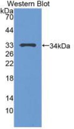 Invitrogen p53 Polyclonal Antibody 20 &mu;L; Unconjugated:Antibodies, Polyclonal
