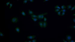 Invitrogen p53 Polyclonal Antibody 200 &mu;L; Unconjugated:Antibodies,