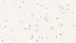 Invitrogen TSG Polyclonal Antibody 200 &mu;L; Unconjugated:Antibodies,