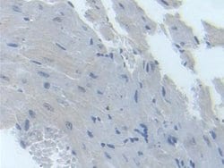 Invitrogen TYK2 Polyclonal Antibody:Antibodies:Primary Antibodies