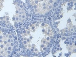 Invitrogen TYK2 Polyclonal Antibody:Antibodies:Primary Antibodies
