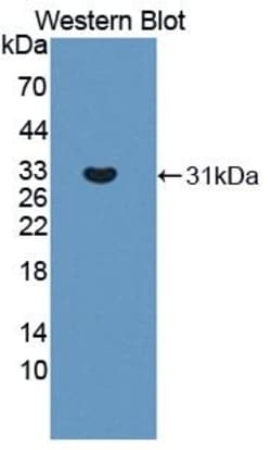 Invitrogen TYK2 Polyclonal Antibody 20 &mu;L | Buy Online | Invitrogen&trade; | Fisher Scientific