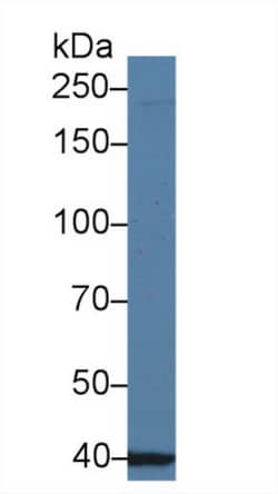 Invitrogen UBAP2 Polyclonal Antibody:Antibodies:Primary Antibodies