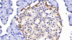 Invitrogen PGP9.5 Polyclonal Antibody:Antibodies:Primary Antibodies